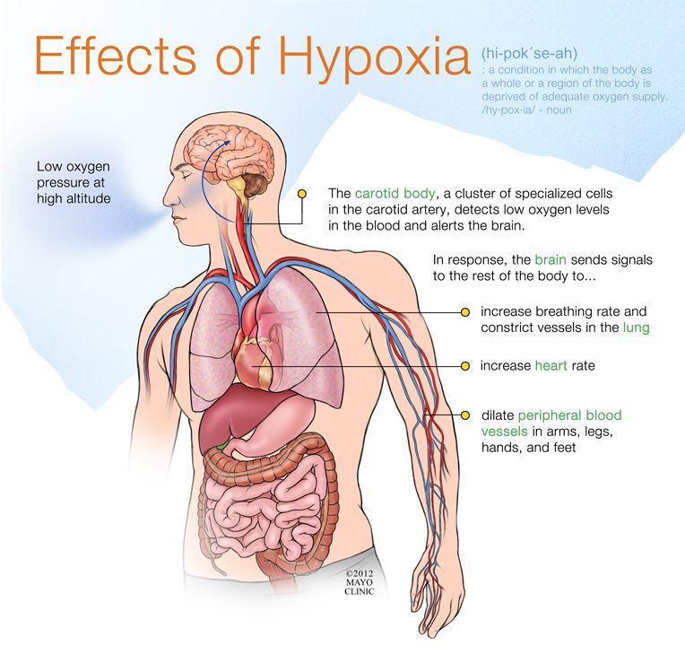 Schematic of how hypoxia works